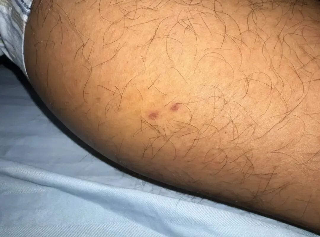 被眼镜蛇咬过的土鸡才是一等的美味 这是真的吗？