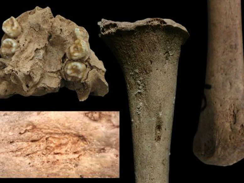 越南史前骨骼研究挑战梅毒起源的关键判断