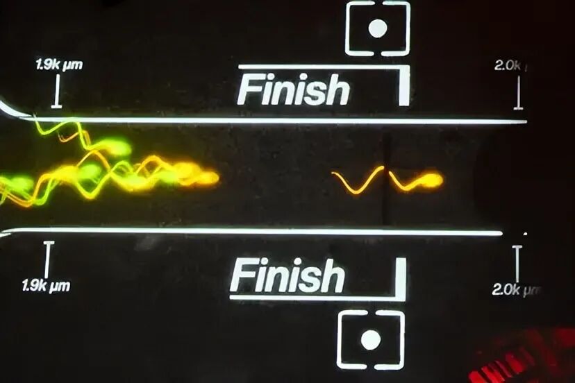 首届全球精子竞速比赛即将举办 奖金10万美元